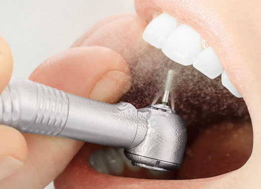 Scaling-and-root-planing-is-a-treatment