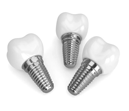 Single-Multiple-Tooth-Dental