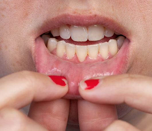 Sometimes-the-connective-tissue