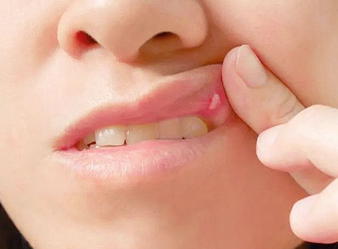 The-key-to-successful-treating