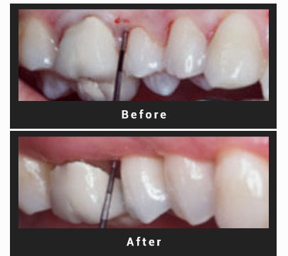 Dental Treatment