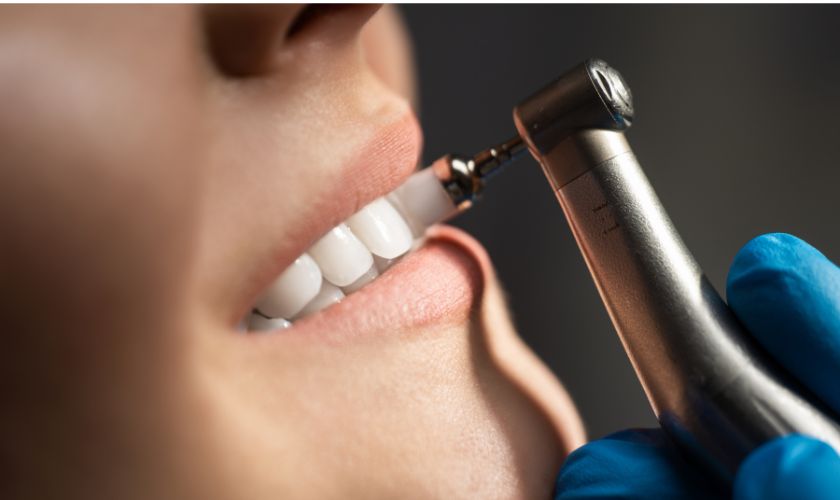Featured image for “Freedom from Plaque and Tartar: How Comprehensive Dental Cleanings Improve Oral Health”