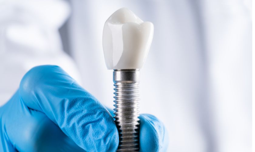 Featured image for “Festive Bites And Implant Delights: Christmas Joy With Dental Implants”