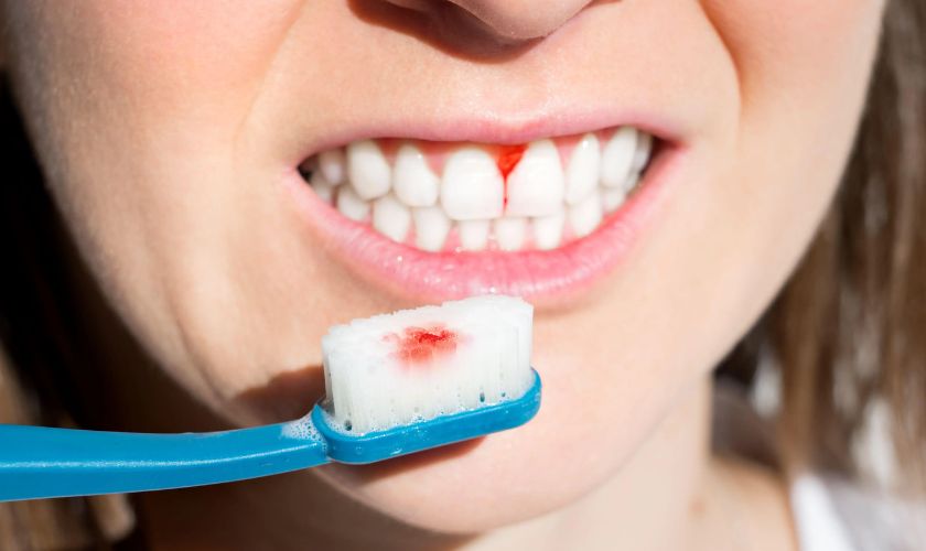 Featured image for “8 Myths About Gum Disease Debunked by A Professional Periodontist”