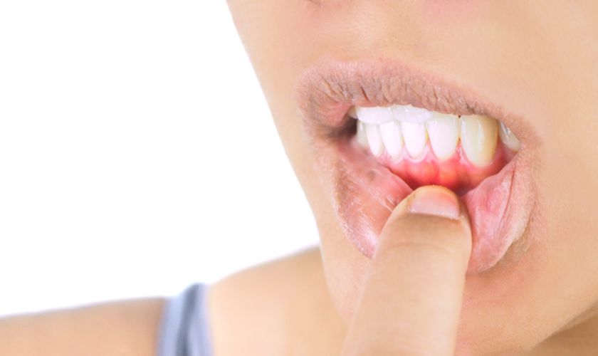 Featured image for “How to Maintain Oral Health with Periodontics Treatment”