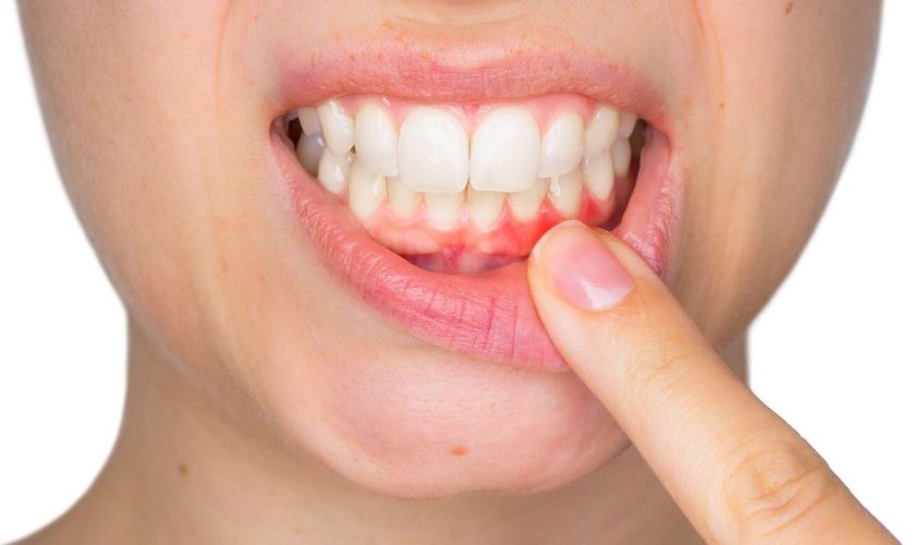 Featured image for “How to Maintain Oral Health After Seeing A Periodontist”