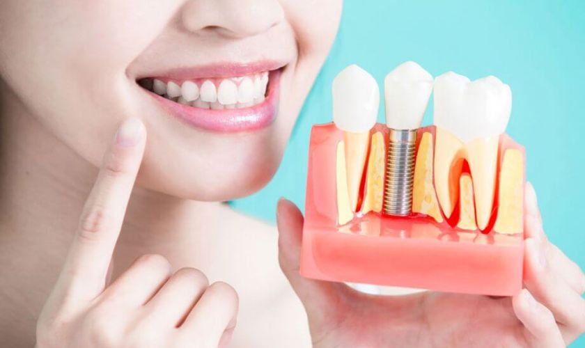 Featured image for “Transform Your Teeth with Dental Implants”