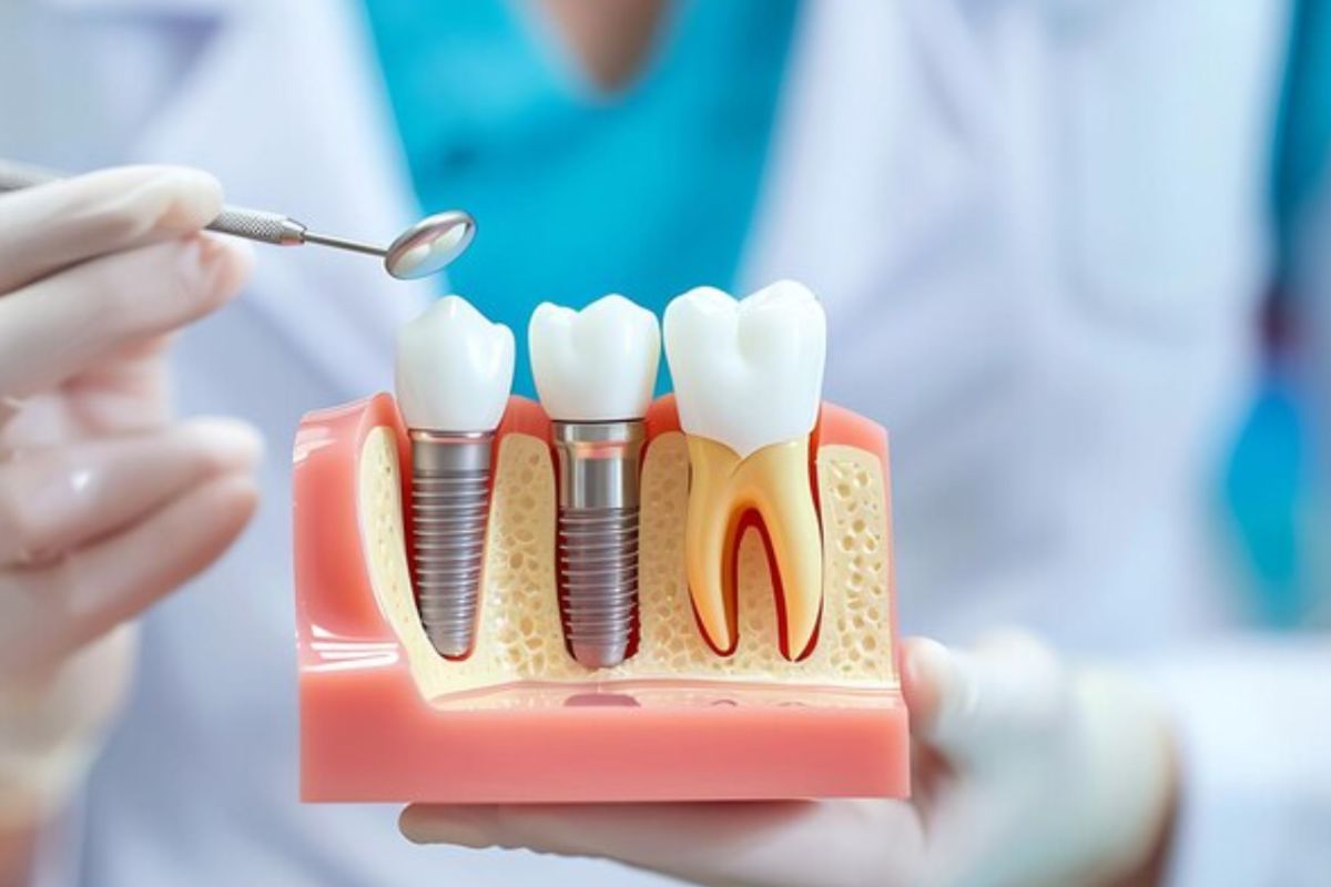 Featured image for “Why Seniors Are Turning To Dental Implants For A Better Smile?”