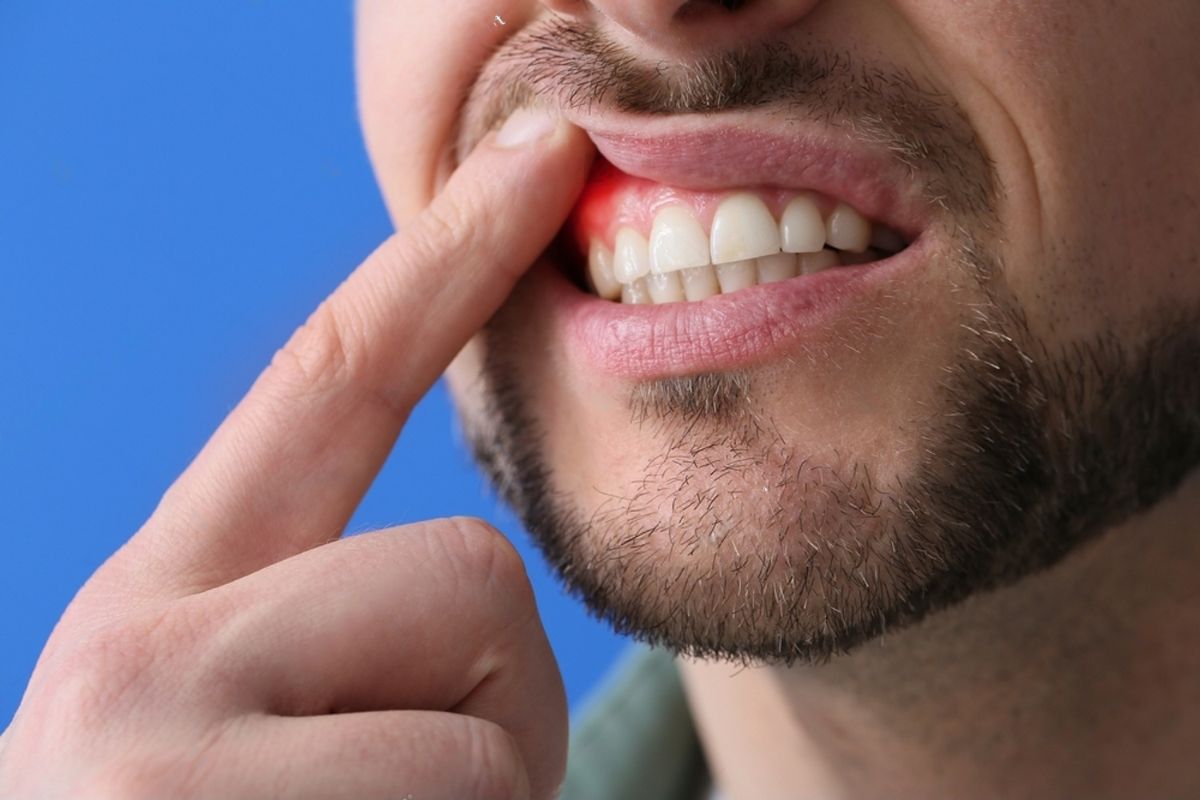 Featured image for “How A Periodontist Can Help Reverse Early Gum Disease”