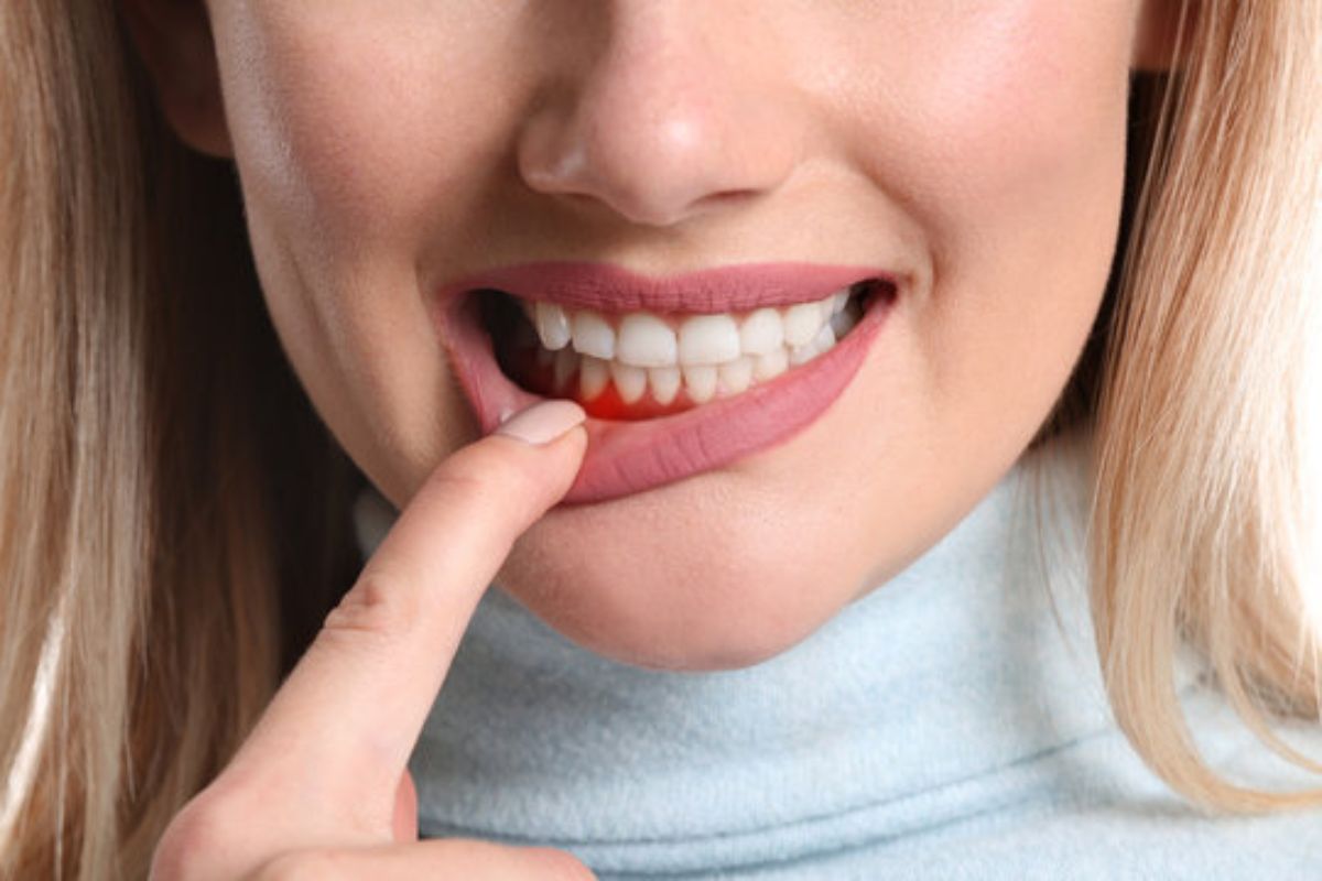 Featured image for “Why Periodontics Treatment is Essential For Gum Health”