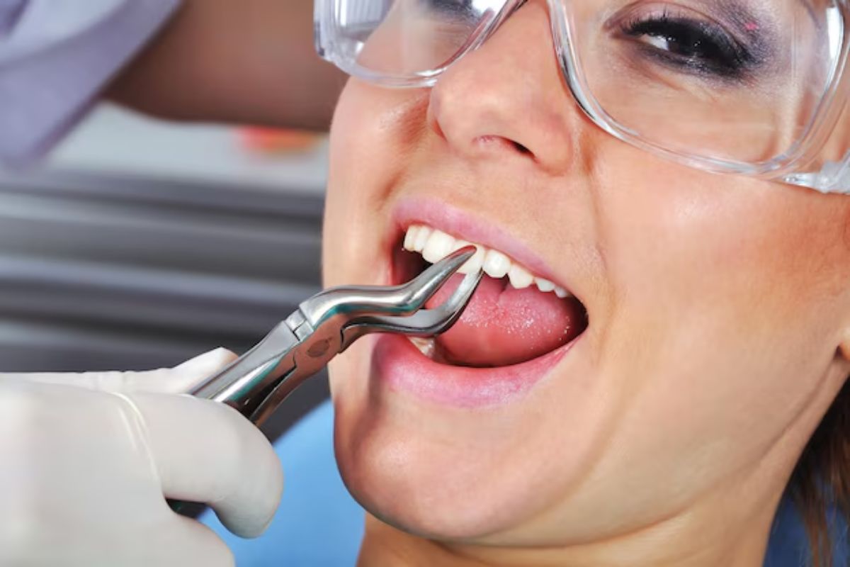 Featured image for “Is Nitrous Oxide Safe For Tooth Extraction?”