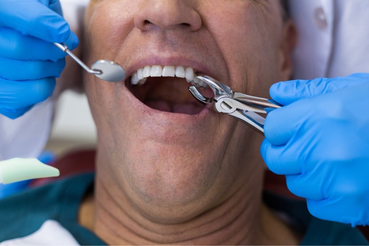 Featured image for “Top Reasons You Might Need a Tooth Extraction”