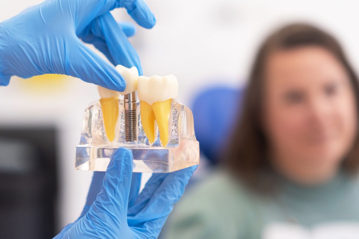 Featured image for “Top Benefits of Choosing Dental Implants in Palm Desert”