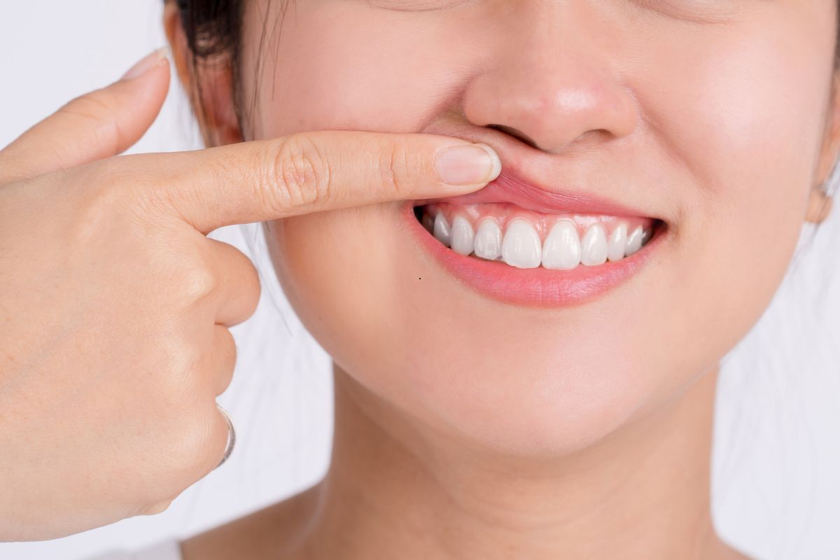 Featured image for “Why Seeing a Palm Desert Periodontist Early Can Save Your Smile”