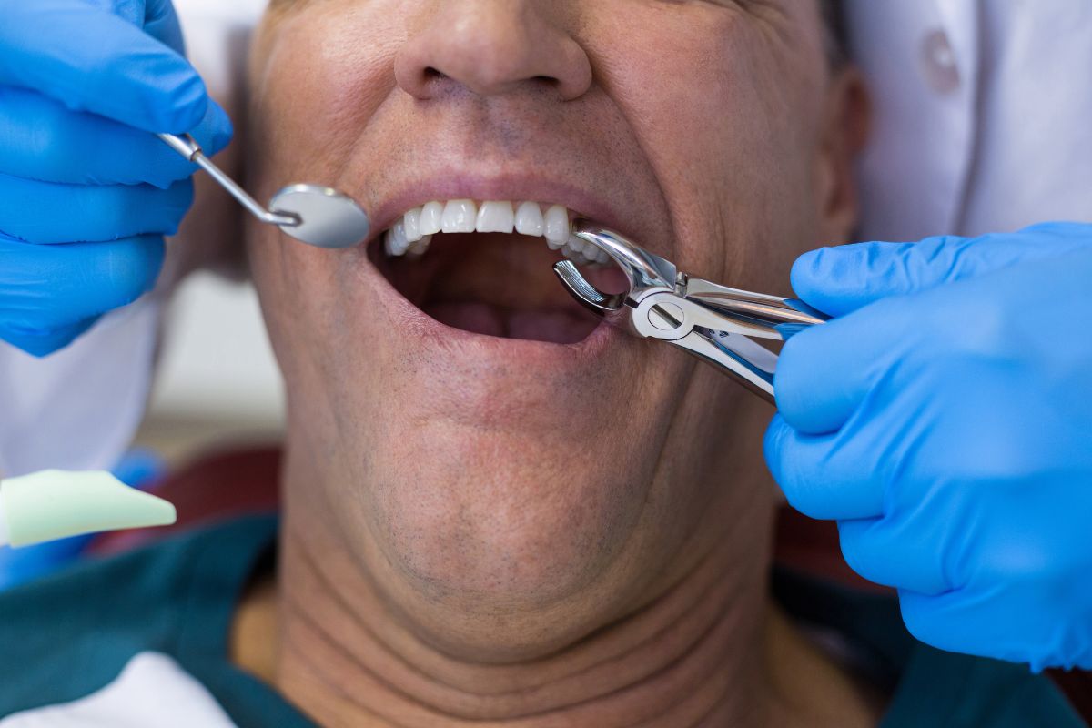 Featured image for “When Is a Tooth Extraction Necessary?”