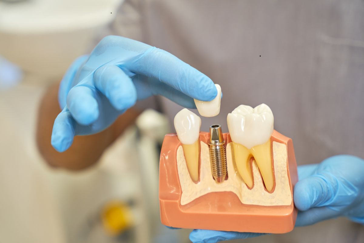 Featured image for “Are Dental Implants the Right Choice for You? A Complete Guide for Palm Desert Patients”