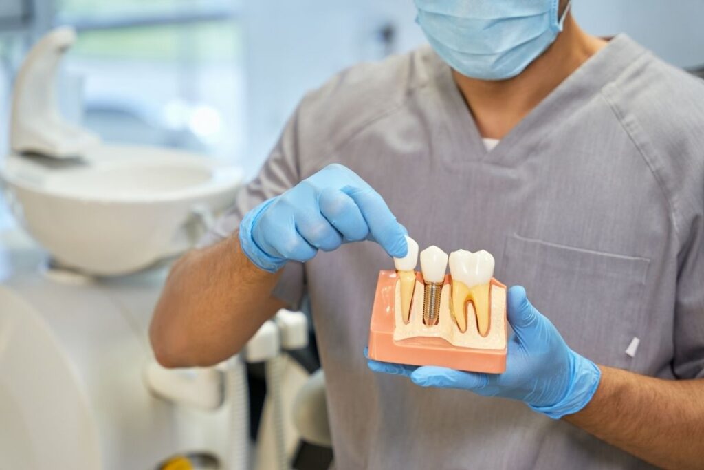 dental implants Palm Desert
