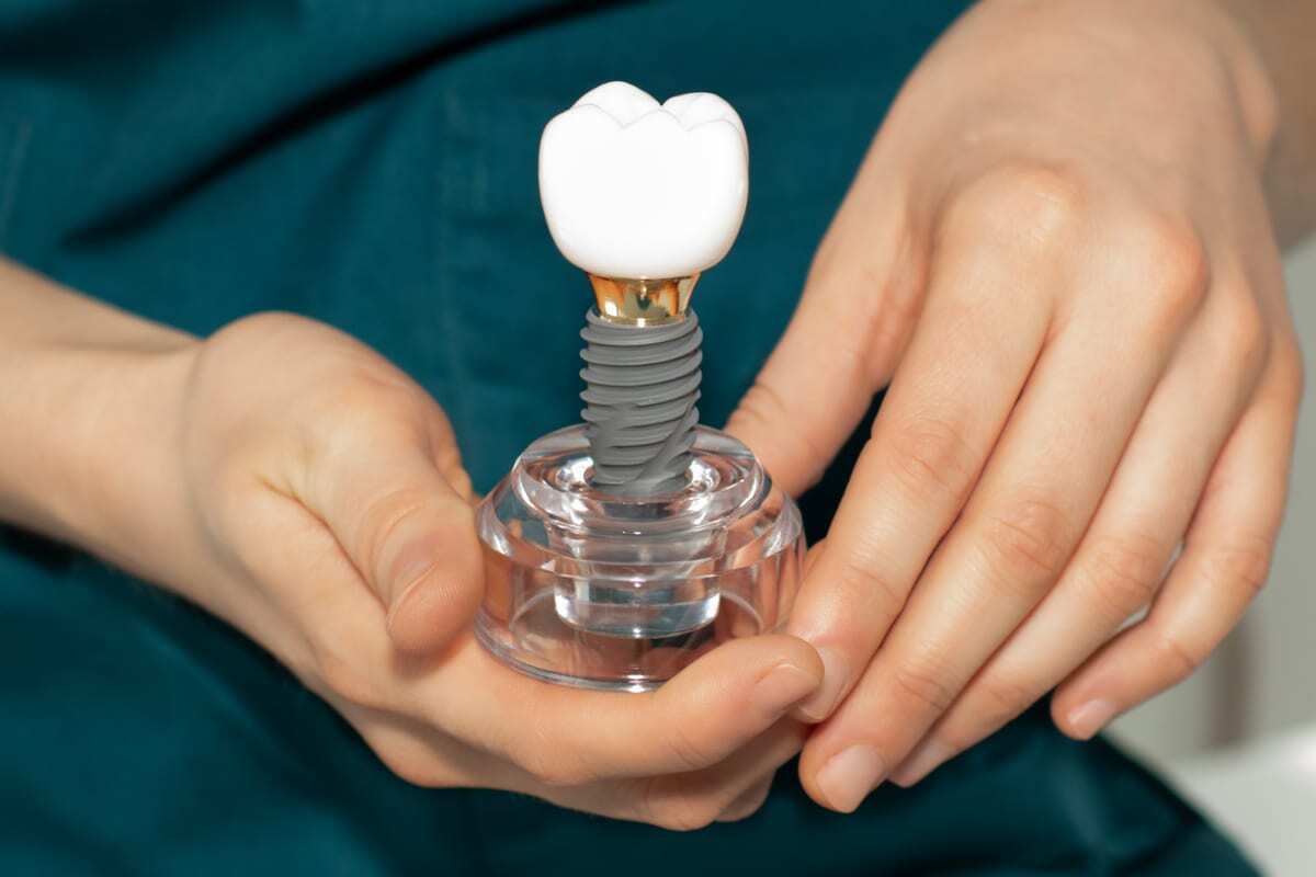 Featured image for “Your Complete Guide to Implant Recovery: Pain, Food, and Timeline”