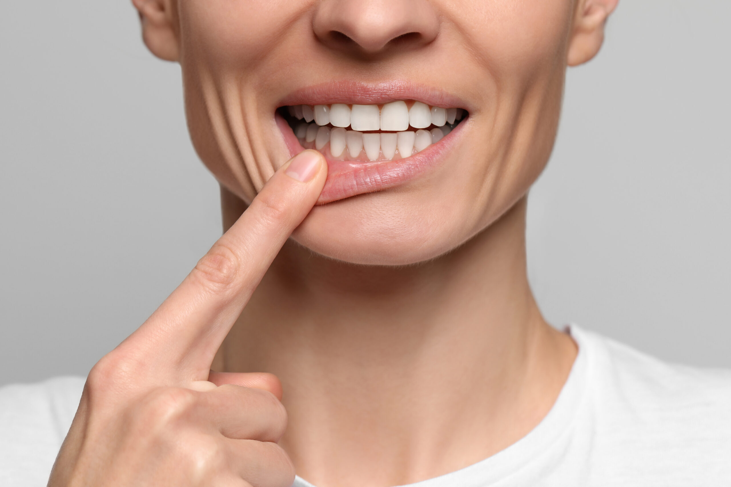 Featured image for “What to Expect After Your Periodontal Treatment: Recovery Week by Week”