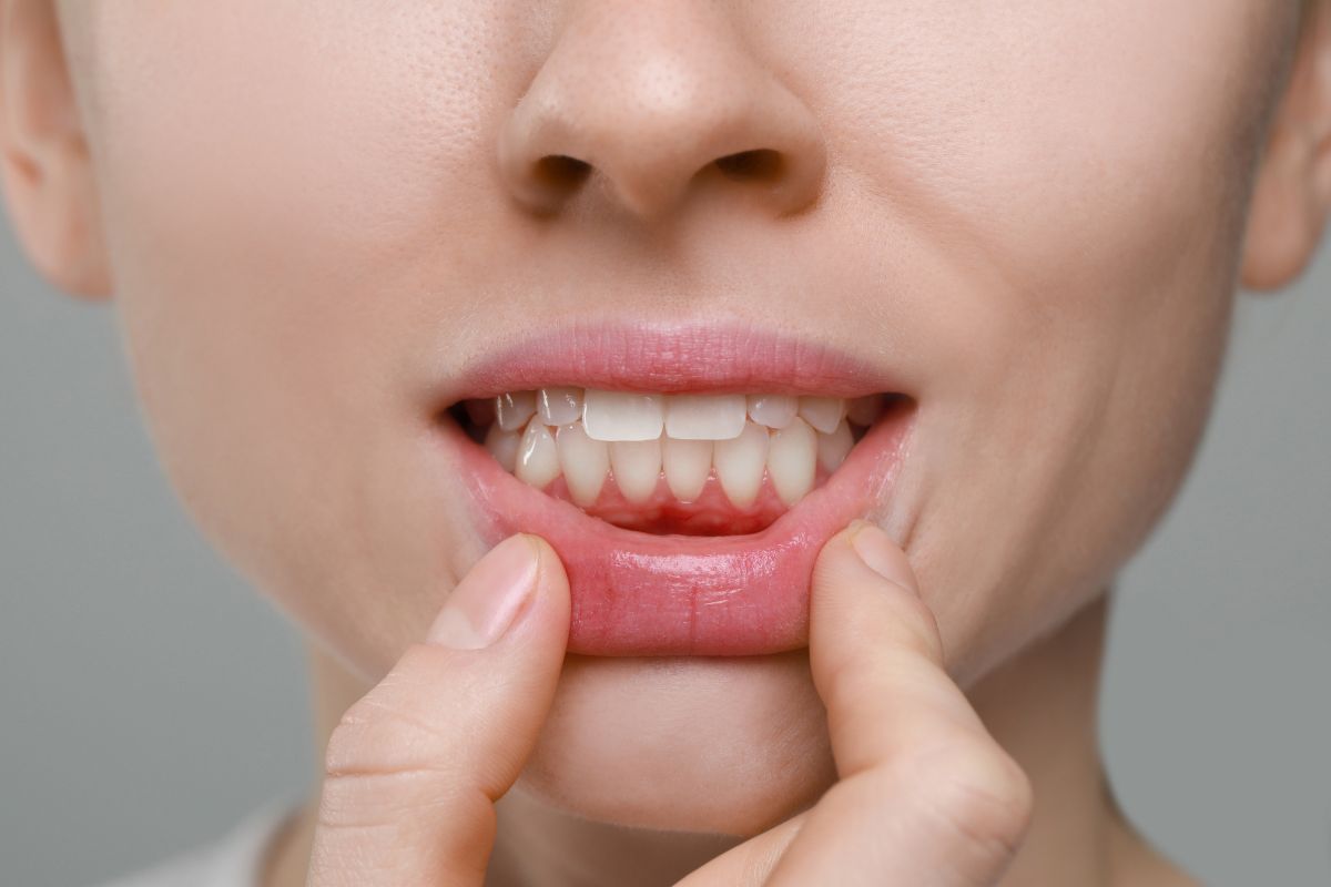 Featured image for “Bad Breath That Won’t Go Away? Your Gums May Need More Than Mouthwash”
